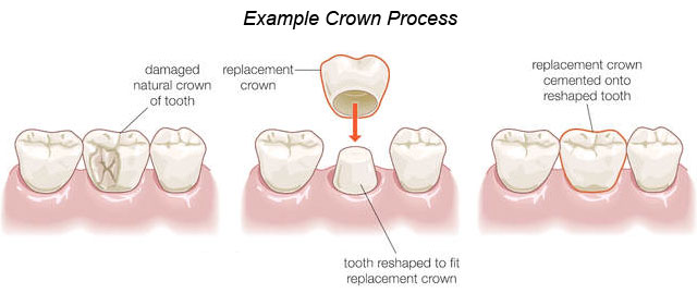 Crown_Process