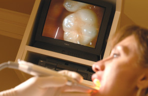 intra-oral-camera